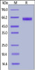 Human PROCR, Fc Tag on SDS-PAGE under reducing (R) condition. The gel was stained overnight with Coomassie Blue. The purity of the protein is greater than 95%.