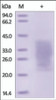 The purity of rh PTH1R / PTHR1 was determined by DTT-reduced (+) SDS-PAGE and staining overnight with Coomassie Blue.