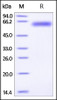 Mouse ROR1, His Tag on SDS-PAGE under reducing (R) condition. The gel was stained overnight with Coomassie Blue. The purity of the protein is greater than 95%.