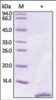 The purity of rh S100P / S100E was determined by DTT-reduced (+) SDS-PAGE and staining overnight with Coomassie Blue.