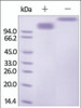 The purity of rh SCARB1 /SR-BI Fc Chimera was determined by DTT-reduced (+) and non-reduced (-) SDS-PAGE and staining overnight with Coomassie Blue.