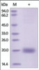 The purity of rh SECTM1 / K12 was determined by DTT-reduced (+) SDS-PAGE and staining overnight with Coomassie Blue.