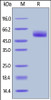 Human Serpin A3, His Tag on SDS-PAGE under reducing (R) condition. The gel was stained overnight with Coomassie Blue. The purity of the protein is greater than 95%.