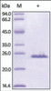 The purity of rh SOD2 / Mn-SOD was determined by DTT-reduced (+) SDS-PAGE and staining overnight with Coomassie Blue.