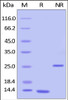 Human TGFB1, Tag Free on SDS-PAGE under reducing (R) and non-reducing (NR) conditions. The gel was stained overnight with Coomassie Blue. The purity of the protein is greater than 95%.