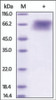 The purity of rh THSD1 / TMTSP was determined by DTT-reduced (+) SDS-PAGE and staining overnight with Coomassie Blue.