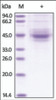 The purity of rh TIGIT / VSIG9 / VSTM3 Fc Chimera was determined by DTT-reduced (+) SDS-PAGE and staining overnight with Coomassie Blue.