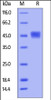 Human TIM-3, His Tag on SDS-PAGE under reducing (R) condition. The gel was stained overnight with Coomassie Blue. The purity of the protein is greater than 95%.
