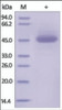 The purity of rh TRAILR1 /DR4 Fc Chimera was determined by DTT-reduced (+) SDS-PAGE and staining overnight with Coomassie Blue.