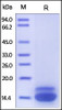Human TRAIL R2, His Tag on SDS-PAGE under reducing (R) condition. The gel was stained overnight with Coomassie Blue. The purity of the protein is greater than 95%.