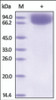 The purity of rh VASN / Vasorin was determined by DTT-reduced (+) SDS-PAGE and staining overnight with Coomassie Blue.