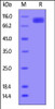 Human VCAM-1, His Tag on SDS-PAGE under reducing (R) condition. The gel was stained overnight with Coomassie Blue. The purity of the protein is greater than 92%.