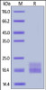 Mouse VEGF120, Tag Free on SDS-PAGE under reducing (R) condition. The gel was stained overnight with Coomassie Blue. The purity of the protein is greater than 95%.