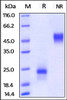 Human VEGF165, Tag Free (HPLC-verified) on SDS-PAGE under reducing (R) and non-reducing (NR) conditions. The gel was stained overnight with Coomassie Blue. The purity of the protein is greater than 98%.