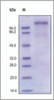 The purity of rh VLDLR was determined by DTT-reduced (+) SDS-PAGE and staining overnight with Coomassie Blue.
