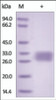 The purity of rh VSIG2 was determined by DTT-reduced (+) SDS-PAGE and staining overnight with Coomassie Blue.