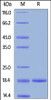 Human G-CSF, Tag Free on SDS-PAGE under reducing (R) condition. The gel was stained overnight with Coomassie Blue. The purity of the protein is greater than 95%.