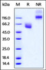 Cynomolgus / Rhesus macaque CD47, Fc Tag on SDS-PAGE under reducing (R) and non-reducing (NR) conditions. The gel was stained overnight with Coomassie Blue. The purity of the protein is greater than 95%.