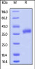 Cynomolgus / Rhesus macaque FOLR1, His Tag on SDS-PAGE under reducing (R) condition. The gel was stained overnight with Coomassie Blue. The purity of the protein is greater than 90%.