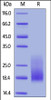 Cynomolgus / Rhesus macaque TIGIT, His Tag (HPLC-verified) on SDS-PAGE under reducing (R) condition. The gel was stained overnight with Coomassie Blue. The purity of the protein is greater than 90%.