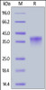 Cynomolgus LILRB4, His Tag on SDS-PAGE under reducing (R) condition. The gel was stained overnight with Coomassie Blue. The purity of the protein is greater than 90%.
