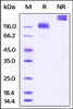 Cynomolgus M-CSF R, Fc Tag on SDS-PAGE under reducing (R) and non-reducing (NR) conditions. The gel was stained overnight with Coomassie Blue. The purity of the protein is greater than 95%.