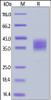 Human B7-H3, His Tag on SDS-PAGE under reducing (R) condition. The gel was stained overnight with Coomassie Blue. The purity of the protein is greater than 95%.