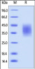 Human B7-H5, His Tag on SDS-PAGE under reducing (R) condition. The gel was stained overnight with Coomassie Blue. The purity of the protein is greater than 95%.