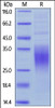 Human BTLA, His Tag on SDS-PAGE under reducing (R) condition. The gel was stained overnight with Coomassie Blue. The purity of the protein is greater than 90%.