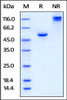 Human BTN3A1, Fc Tag on SDS-PAGE under reducing (R) and no-reducing (NR) conditions. The gel was stained overnight with Coomassie Blue. The purity of the protein is greater than 95%.