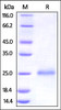 Human CD99, His Tag on SDS-PAGE under reducing (R) condition. The gel was stained overnight with Coomassie Blue. The purity of the protein is greater than 95%.