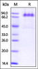 Human Dkk-1, Fc Tag on SDS-PAGE under reducing (R) condition. The gel was stained overnight with Coomassie Blue. The purity of the protein is greater than 95%.