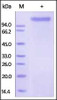 Human E-Selectin, Fc Tag on SDS-PAGE under reducing (R) condition. The gel was stained overnight with Coomassie Blue. The purity of the protein is greater than 95%.