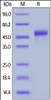Human Galectin-9, His Tag on SDS-PAGE under reducing (R) condition. The gel was stained overnight with Coomassie Blue. The purity of the protein is greater than 95%.