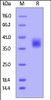 Human M-CSF, His Tag on SDS-PAGE under reducing (R) condition. The gel was stained overnight with Coomassie Blue. The purity of the protein is greater than 95%.