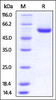 Human ROR2, His Tag on SDS-PAGE under reducing (R) condition. The gel was stained overnight with Coomassie Blue. The purity of the protein is greater than 95%.