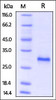 Mouse CD40, His Tag on SDS-PAGE under reducing (R) condition. The gel was stained overnight with Coomassie Blue. The purity of the protein is greater than 95%.