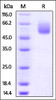 Mouse CD47, Fc Tag on SDS-PAGE under reducing (R) condition. The gel was stained overnight with Coomassie Blue. The purity of the protein is greater than 95%.