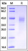 Mouse Dkk-1, His Tag on SDS-PAGE under reducing (R) condition. The gel was stained overnight with Coomassie Blue. The purity of the protein is greater than 95%.