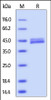 Mouse Galectin-4, His tag on SDS-PAGE under reducing (R) condition. The gel was stained overnight with Coomassie Blue. The purity of the protein is greater than 92%.