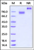 Mouse IL-23 R, Fc Tag on SDS-PAGE under reducing (R) and no-reducing (NR) conditions. The gel was stained overnight with Coomassie Blue. The purity of the protein is greater than 95%.