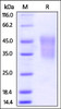 Mouse TIM-3 / HAVCR2, His Tag on SDS-PAGE under reducing (R) condition. The gel was stained overnight with Coomassie Blue. The purity of the protein is greater than 95%.