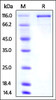 Mouse Transferrin R2, mouse IgG1 Fc Tag on SDS-PAGE under reducing (R) condition. The gel was stained overnight with Coomassie Blue. The purity of the protein is greater than 95%.