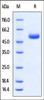 Rabbit CTLA-4 Protein, Fc Tag on SDS-PAGE under reducing (R) condition. The gel was stained overnight with Coomassie Blue. The purity of the protein is greater than 95%.