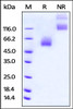 Rat CD47, Fc Tag on SDS-PAGE under reducing (R) and no-reducing (NR) conditions. The gel was stained overnight with Coomassie Blue. The purity of the protein is greater than 95%.