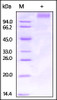 Ebolavirus EBOV (subtype Zaire, strain Kikwit-95) GP1 on SDS-PAGE under reducing (R) condition. The gel was stained overnight with Coomassie Blue. The purity of the protein is greater than 95%.