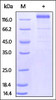 HCMV Glycoprotein B (gB) , Fc Tag on SDS-PAGE under reducing (R) condition. The gel was stained overnight with Coomassie Blue. The purity of the protein is greater than 85%.