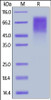 HRSV (A) Glycoprotein G, His Tag on SDS-PAGE under reducing (R) condition. The gel was stained overnight with Coomassie Blue. The purity of the protein is greater than 90%.
