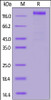 SARS-CoV-2 (COVID-19) S1 recombinant protein on SDS-PAGE under reducing (R) condition. The gel was stained overnight with Coomassie Blue. The purity of the protein is greater than 95%.