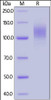 SARS-CoV-2 (COVID-19) S1 recombinant protein on SDS-PAGE under reducing (R) condition. The gel was stained overnight with Coomassie Blue. The purity of the protein is greater than 90%.